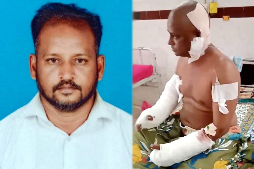 மாமுல் தரமறுத்த காண்ட்ராக்டர்... ஆத்திரத்தில் வெட்டிய கஞ்சா போதை ஆசாமிகள்..