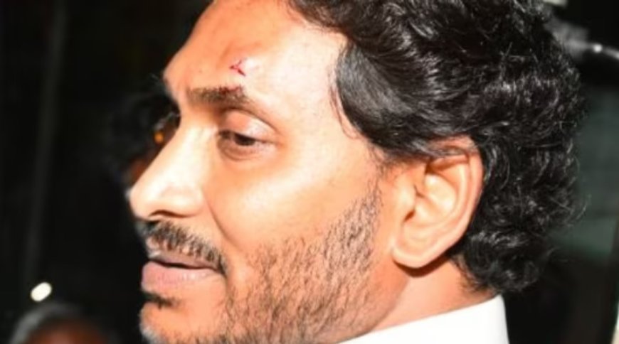 ஆந்திர முதலமைச்சர் ஜெகன் மோகன் ரெட்டியை கல்லால் தலையில் தாக்கிய நபர் மீது கொலை முயற்சி வழக்குப்பதிவு...