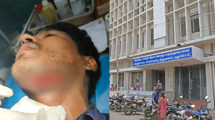 புதுவை மருத்துவமனையில் பரபரப்பு : "என் மகனுக்கு சரியா மருத்துவம் பார்க்கல..." மருத்துவரின் கழுத்தை அறுத்த முதியவர்...